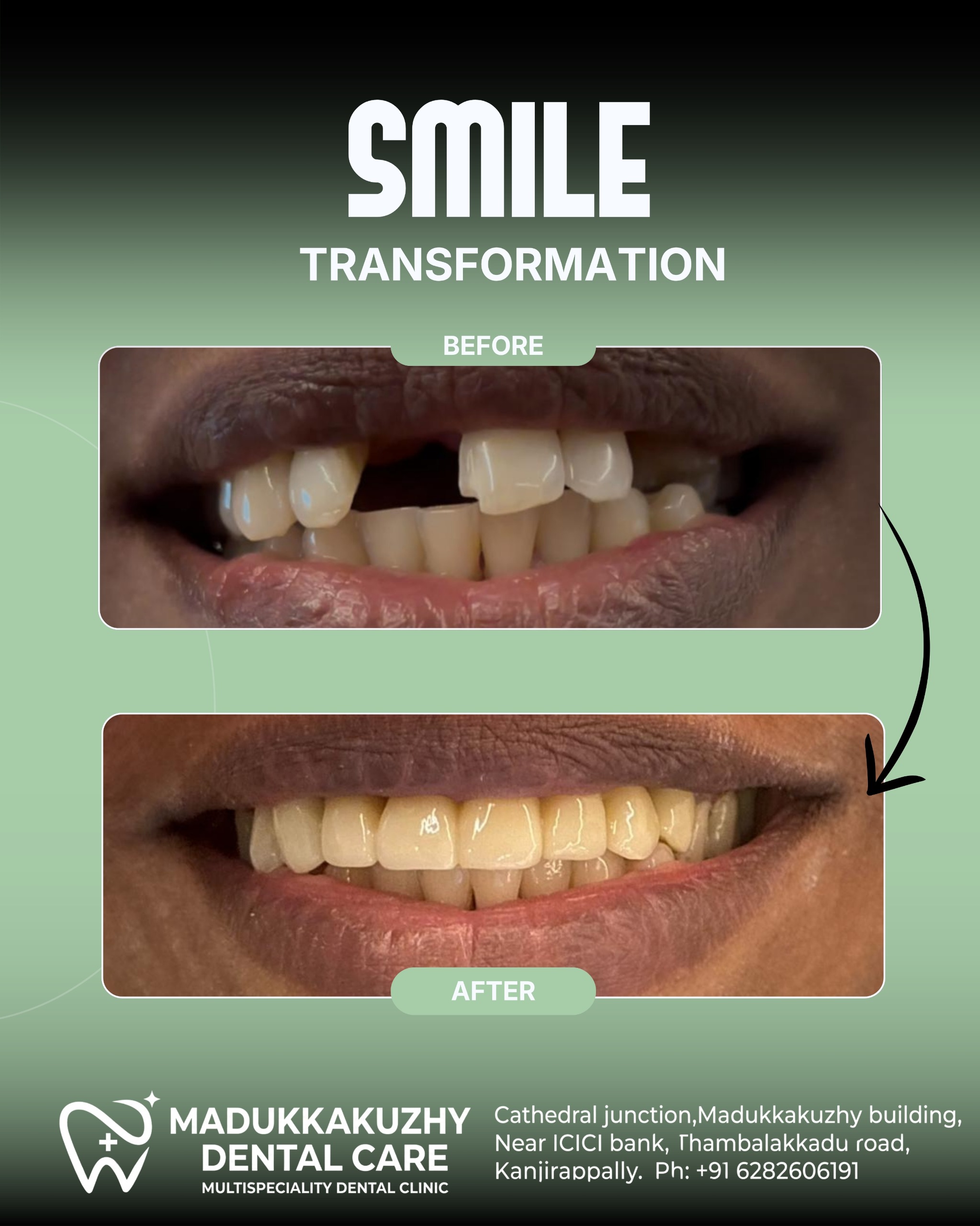 Smile Gallery 1