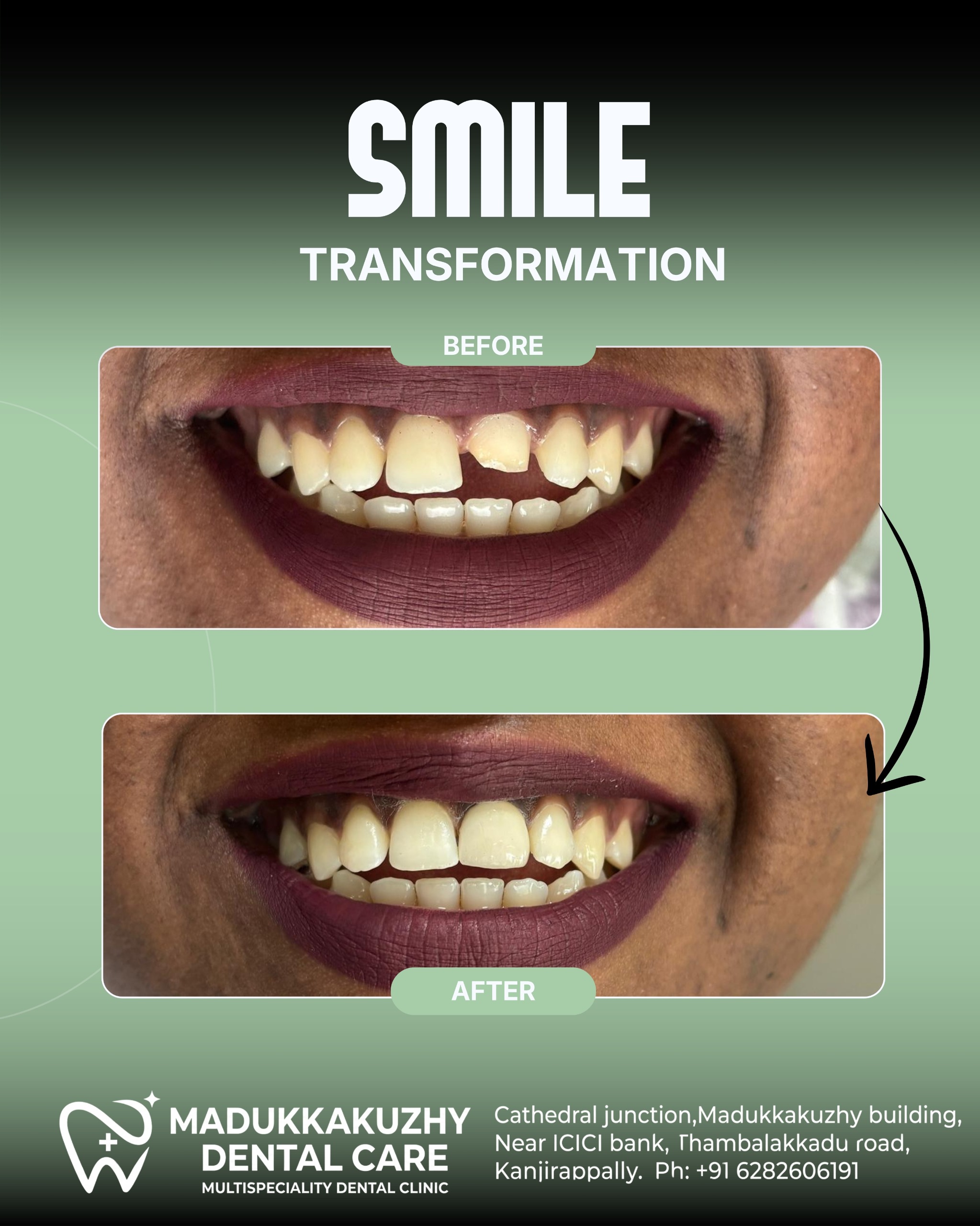 Smile Gallery 2