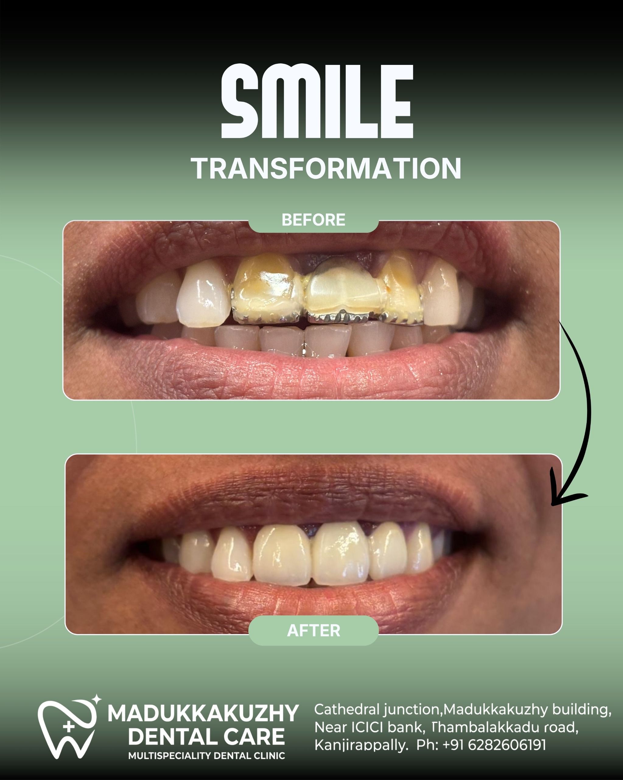 Smile Gallery 3