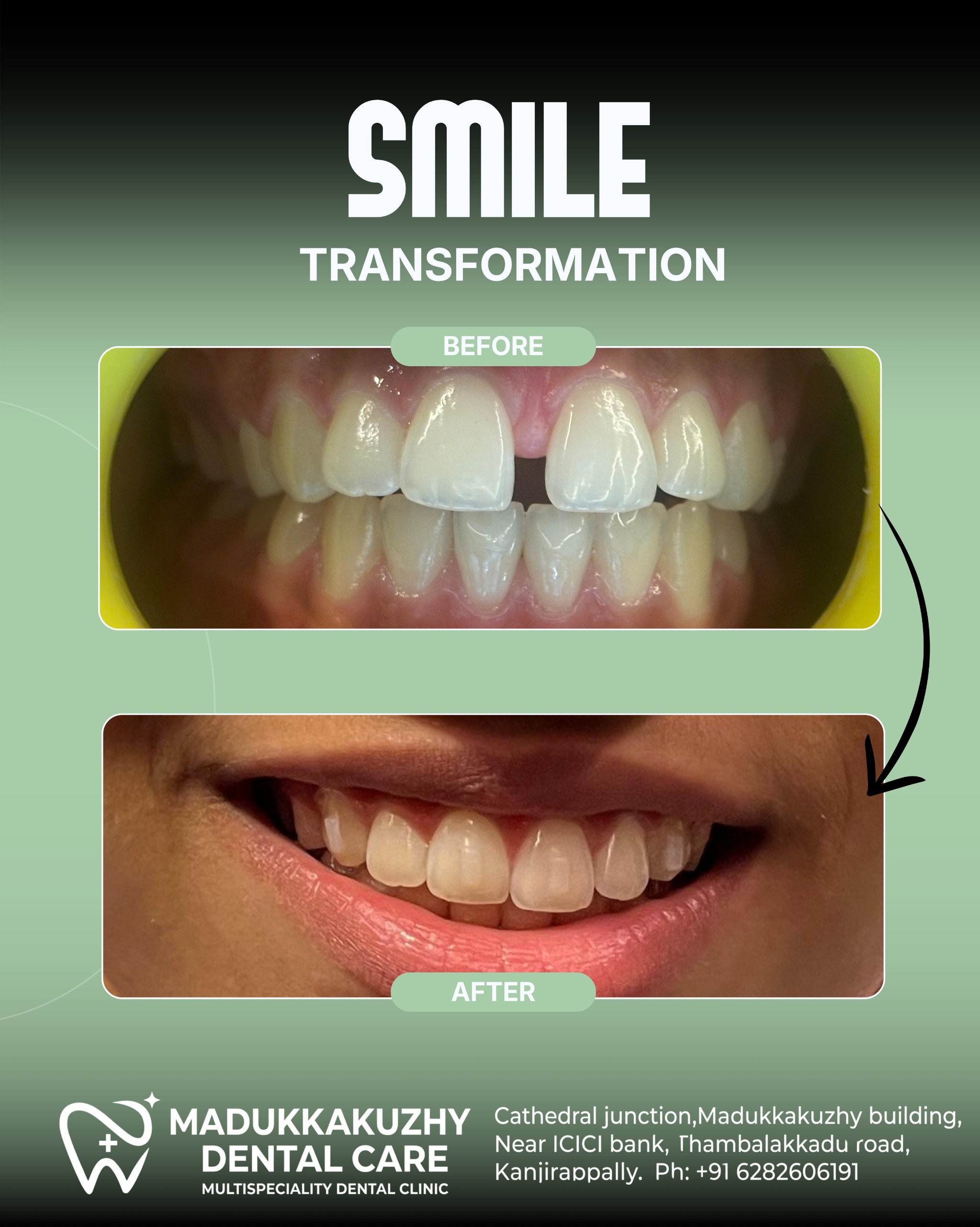 Smile Gallery 4