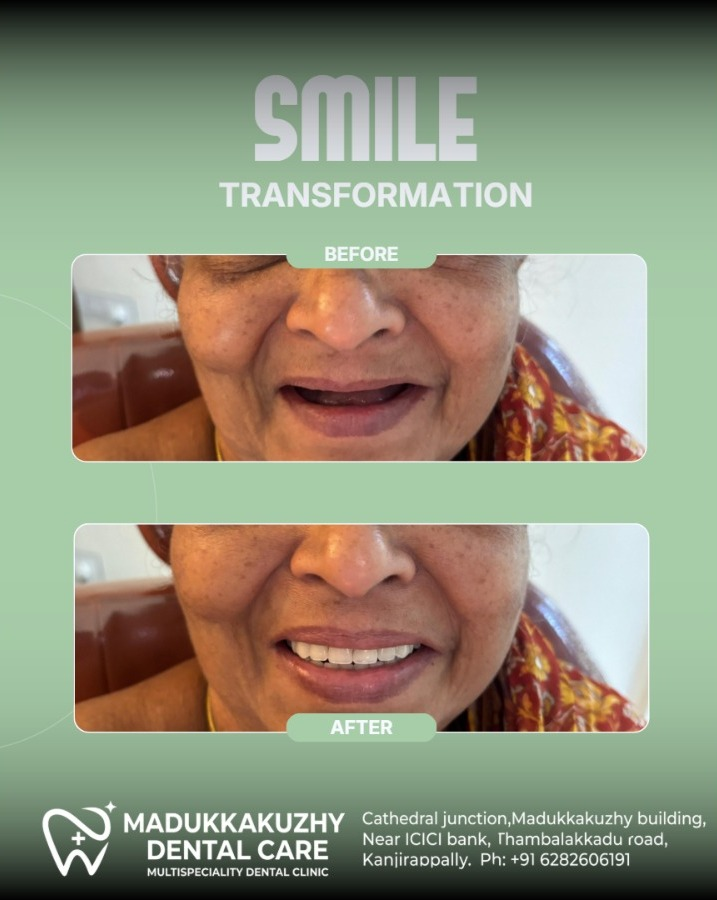 Smile Gallery 4