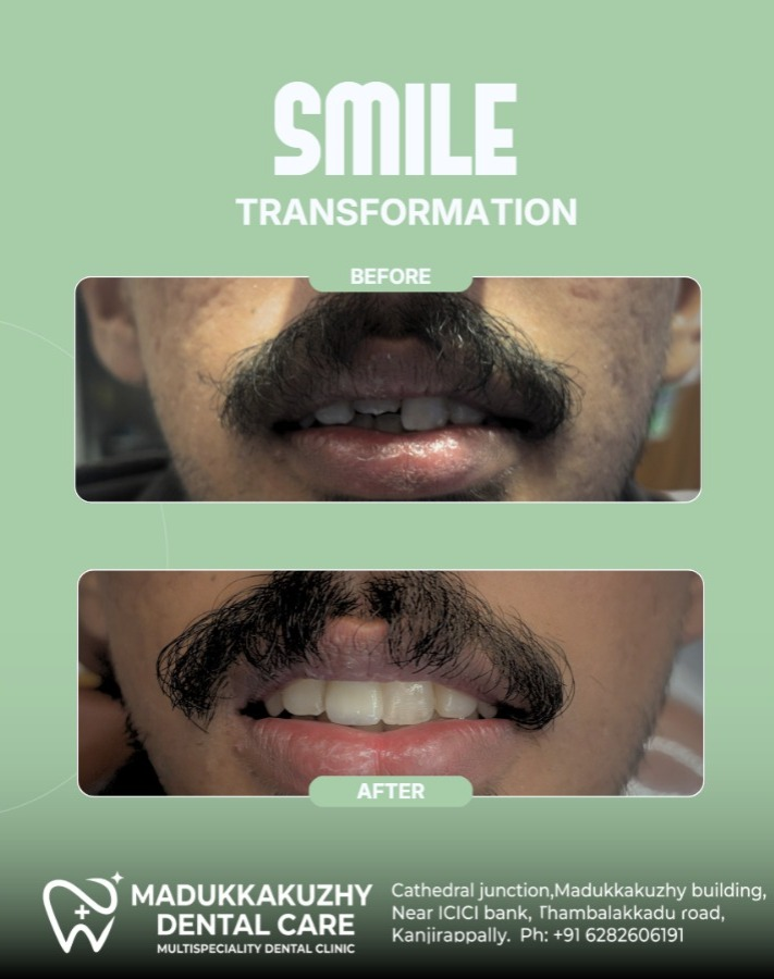 Smile Gallery 4