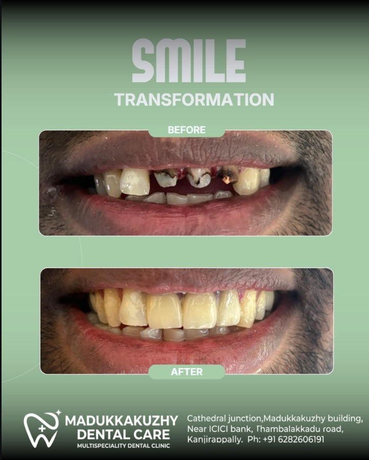 Smile Gallery 4