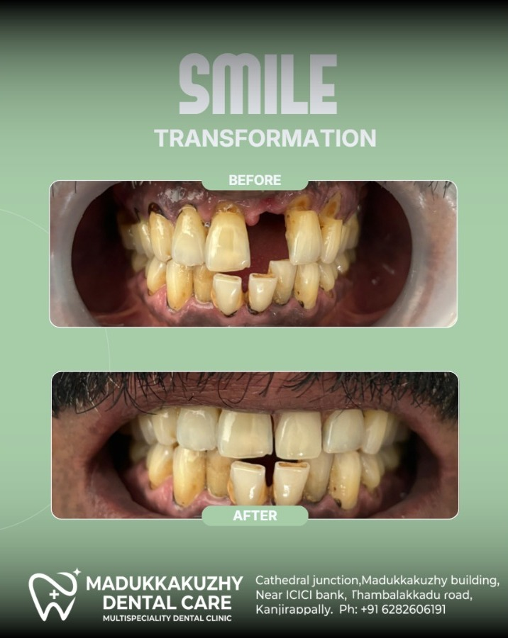 Smile Gallery 4