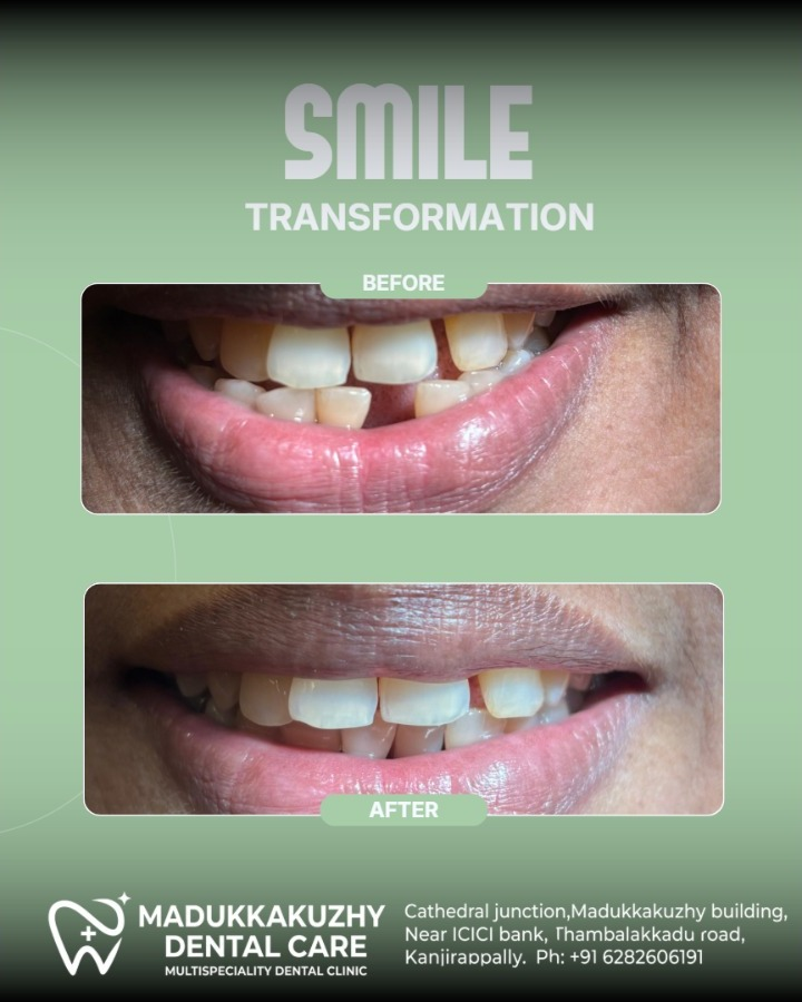 Smile Gallery 4